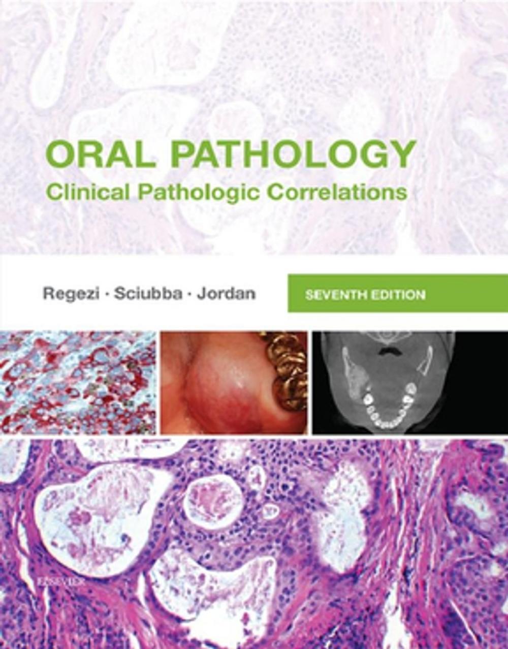 Big bigCover of Oral Pathology - E-Book