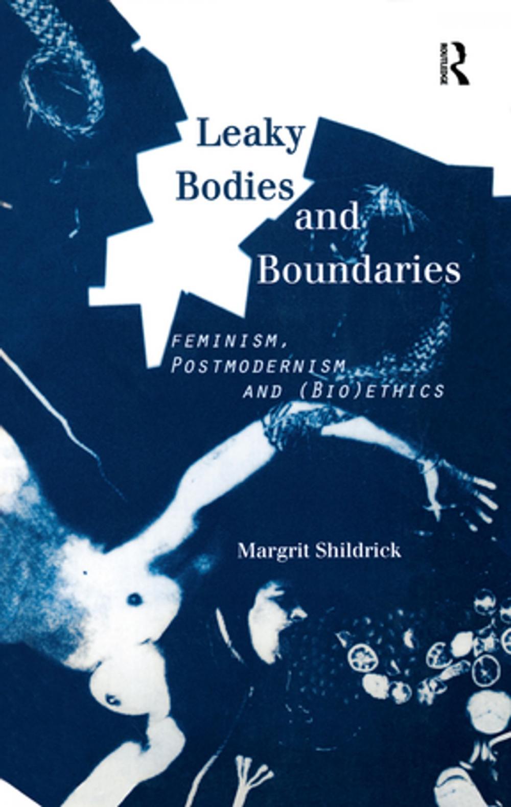 Big bigCover of Leaky Bodies and Boundaries