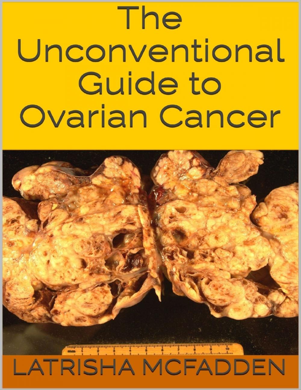 Big bigCover of The Unconventional Guide to Ovarian Cancer