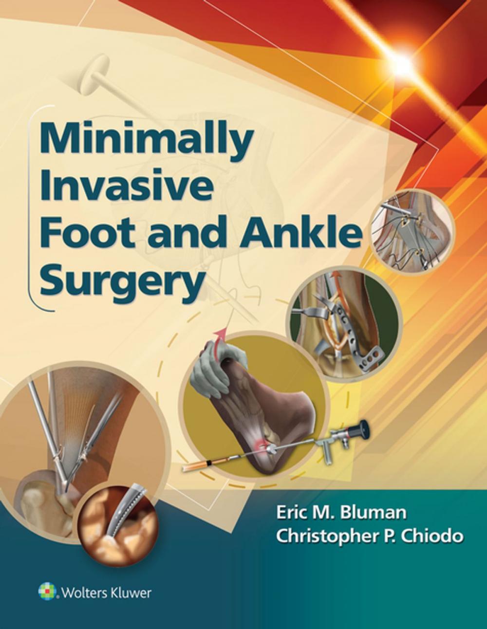 Big bigCover of Minimally Invasive Foot & Ankle Surgery