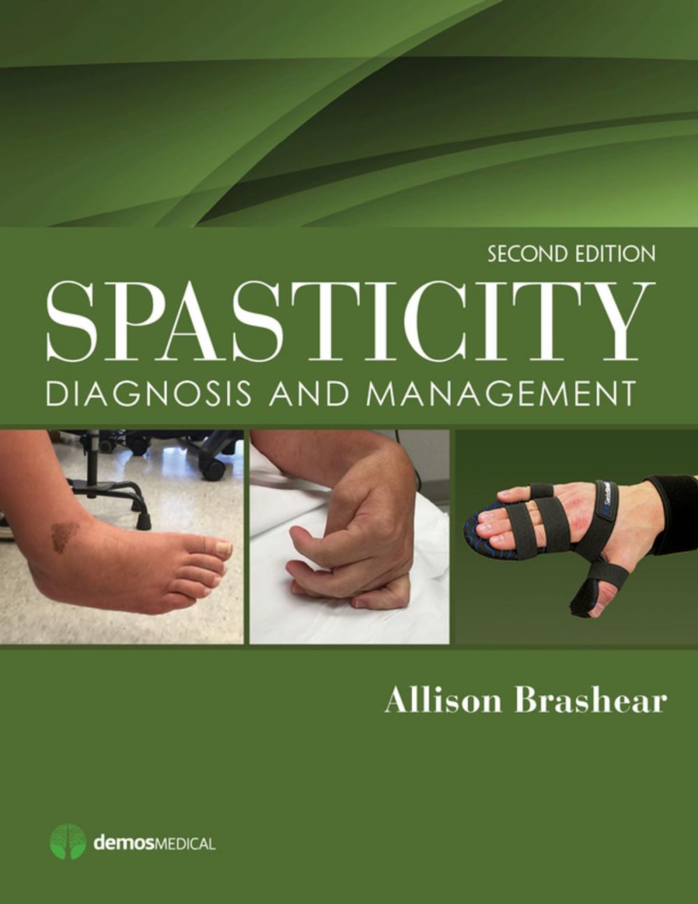 Big bigCover of Spasticity, Second Edition