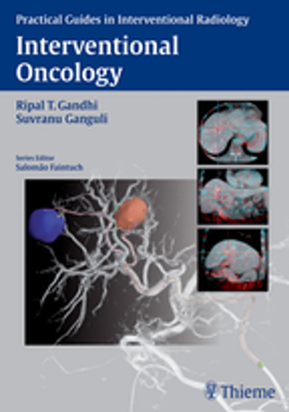 Big bigCover of Interventional Oncology