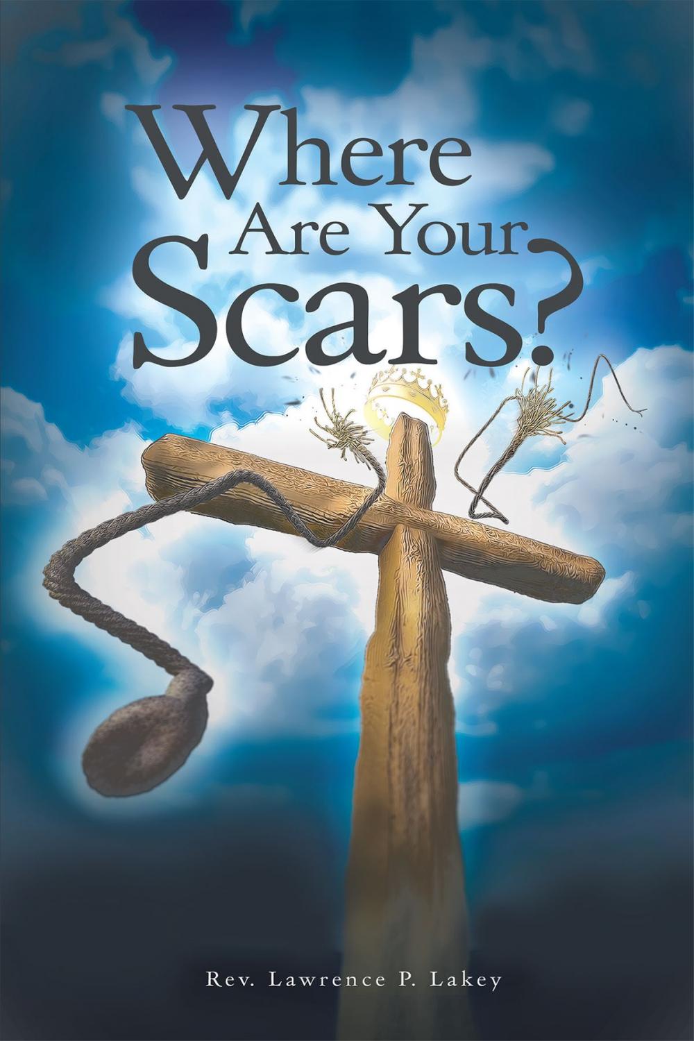 Big bigCover of Where Are Your Scars?