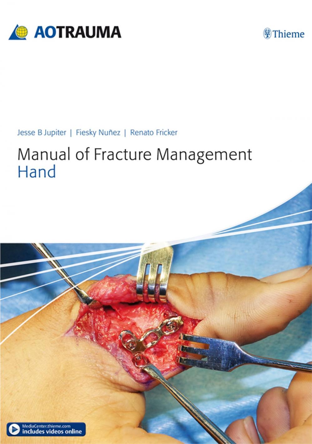 Big bigCover of Manual of Fracture Management - Hand