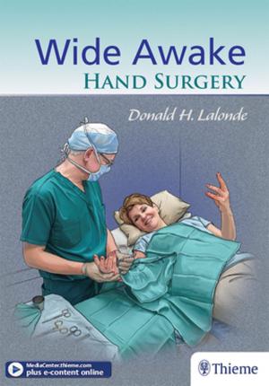 Cover of the book Wide Awake Hand Surgery by Sigurd Pechlaner, Fridun Kerschbaumer