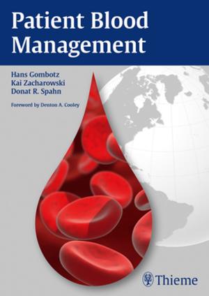 Cover of the book Patient Blood Management by Vincent Chong, Suresh Kumar Mukherji