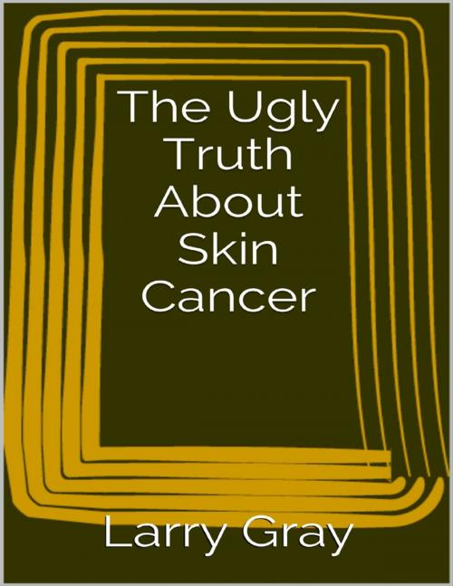 Cover of the book The Ugly Truth About Skin Cancer by Larry Gray, Lulu.com