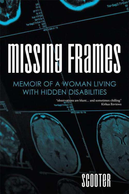 Cover of the book Missing Frames by Scooter, AuthorHouse