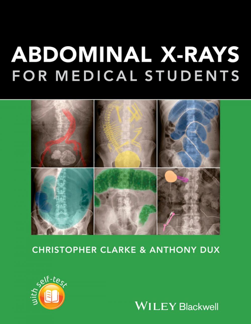 Big bigCover of Abdominal X-rays for Medical Students