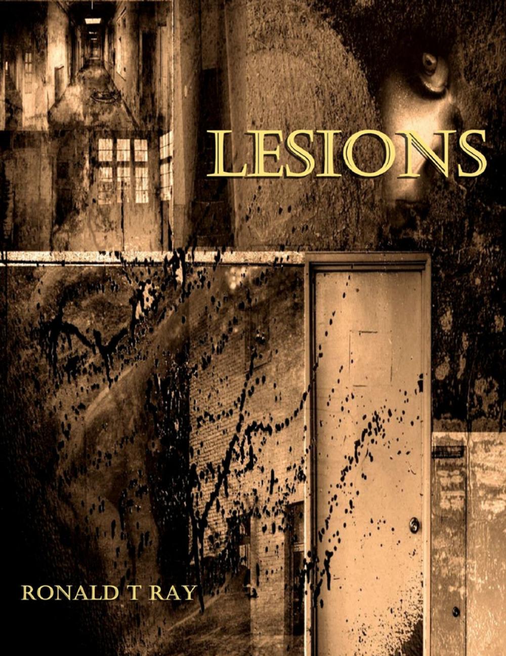 Big bigCover of Lesions