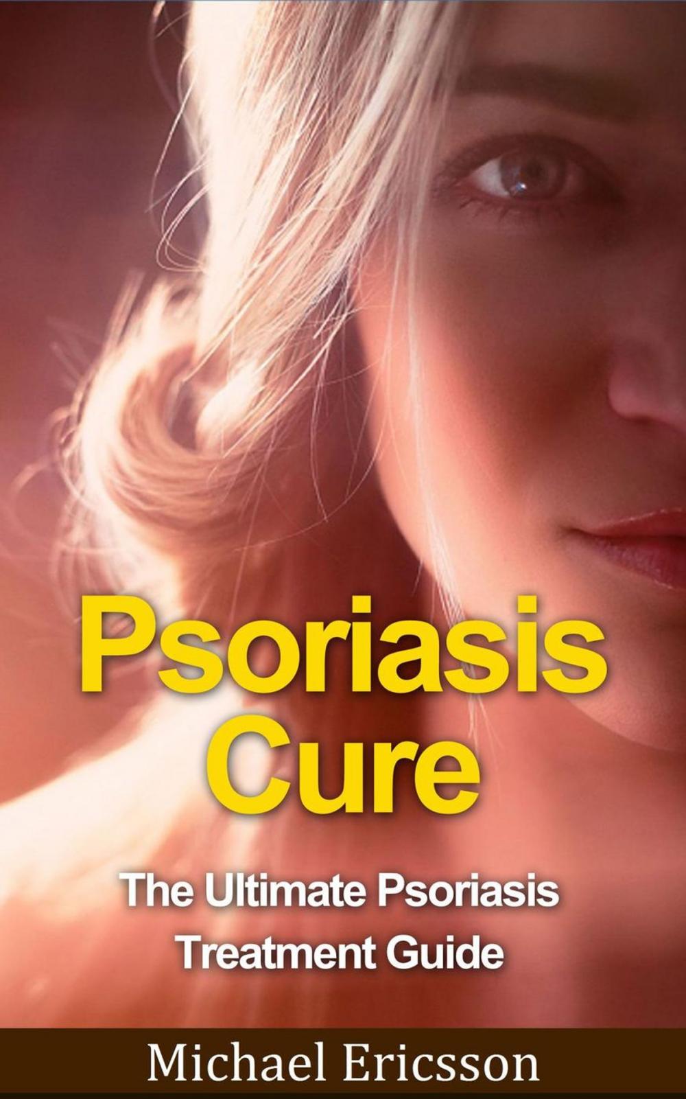 Big bigCover of Psoriasis Cure: The Ultimate Psoriasis Treatment Guide