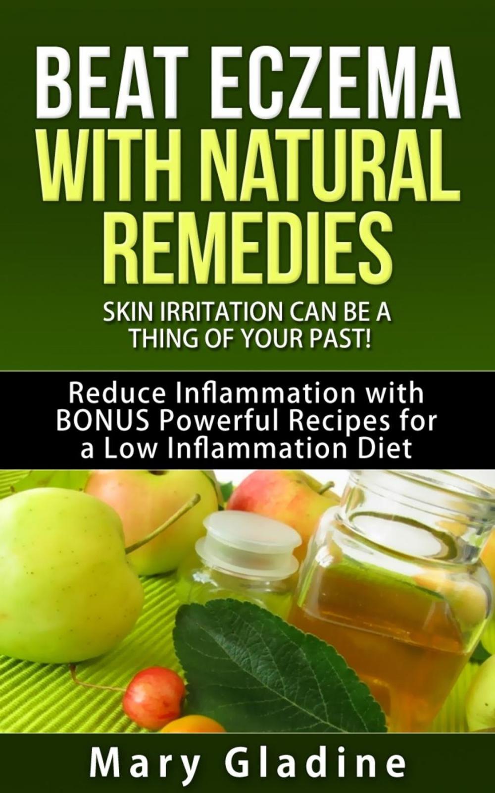 Big bigCover of Beat Eczema: Skin Irritation can be a thing of your past! Natural Eczema Remedies PLUS Reduce Inflammation with BONUS Powerful Recipes and Food Tips for a Low Inflammation Diet