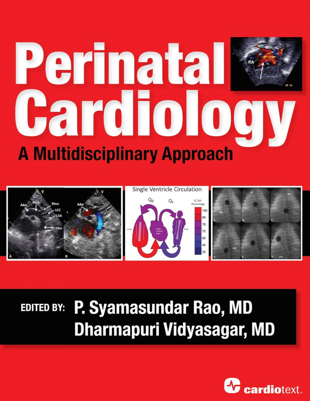 Big bigCover of Perinatal Cardiology: A Multidisciplinary Approach