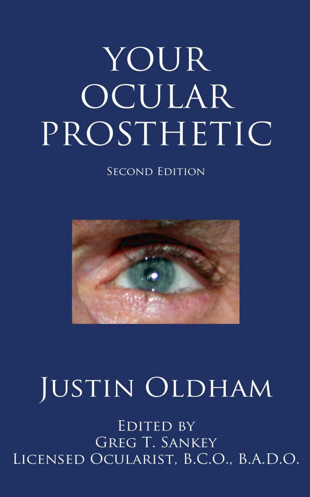 Big bigCover of Your Ocular Prosthetic