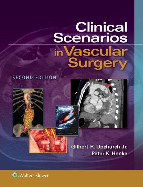 Cover of the book Clinical Scenarios in Vascular Surgery by Gilbert R. Upchurch, Peter K. Henke, Wolters Kluwer Health