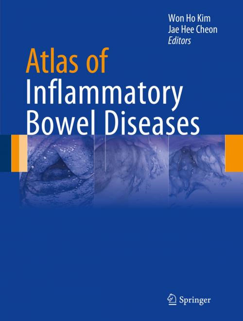 Cover of the book Atlas of Inflammatory Bowel Diseases by , Springer Berlin Heidelberg