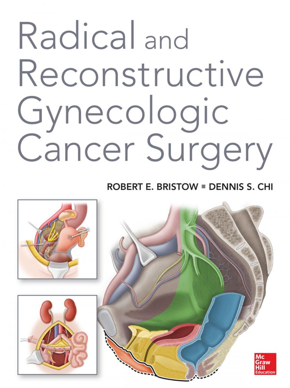 Big bigCover of Radical and Reconstructive Gynecologic Cancer Surgery