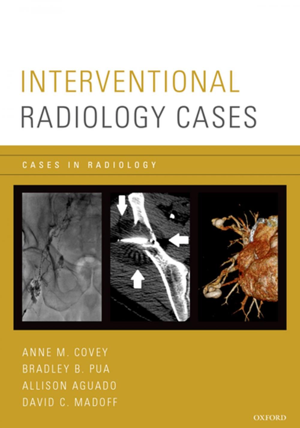 Big bigCover of Interventional Radiology Cases