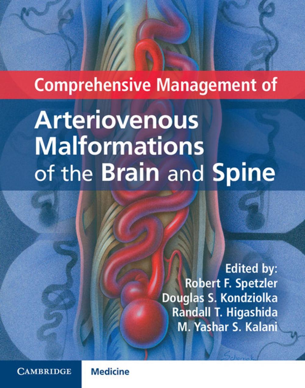 Big bigCover of Comprehensive Management of Arteriovenous Malformations of the Brain and Spine