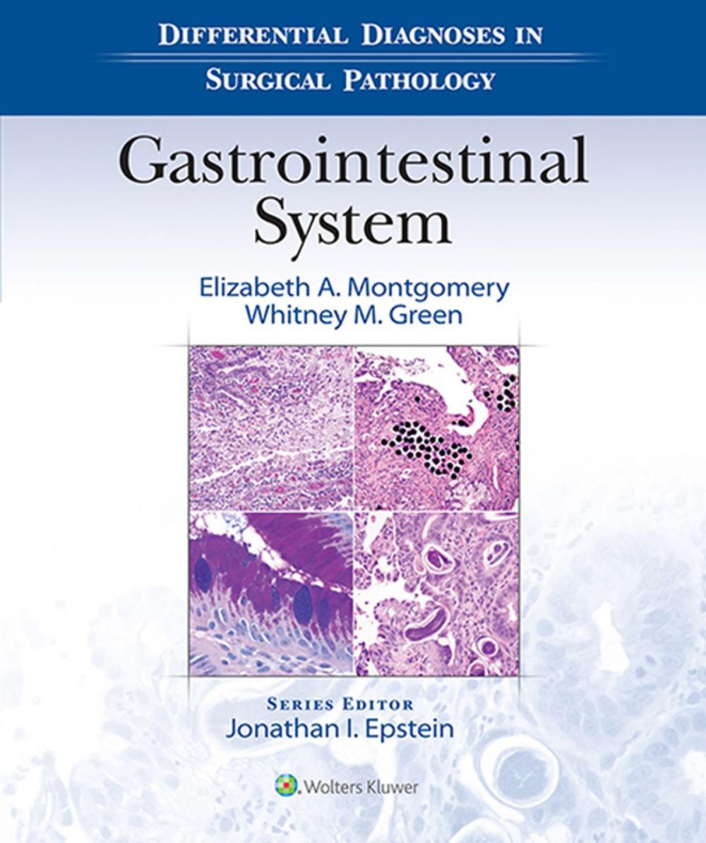 Big bigCover of Differential Diagnoses in Surgical Pathology: Gastrointestinal System