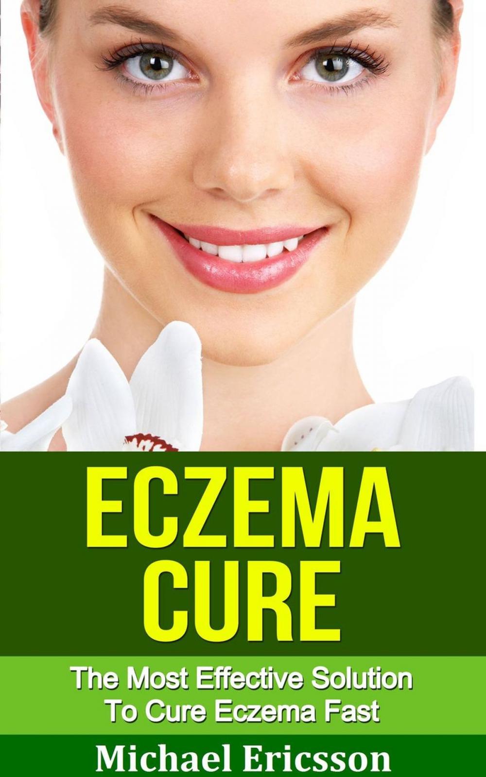 Big bigCover of Eczema Cure: The Most Effective Solution to Cure Eczema Fast