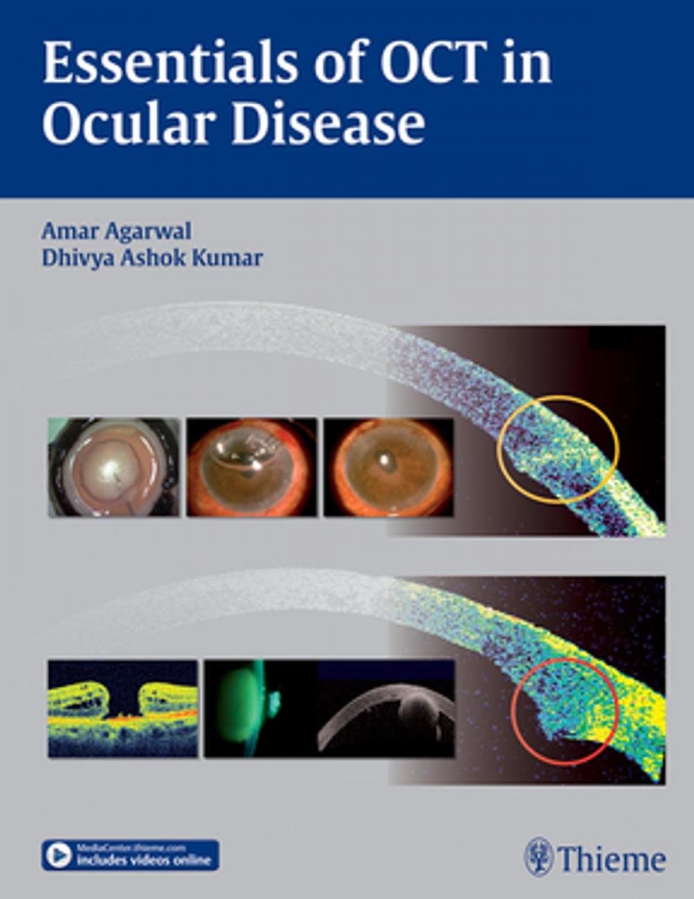 Big bigCover of Essentials of OCT in Ocular Disease