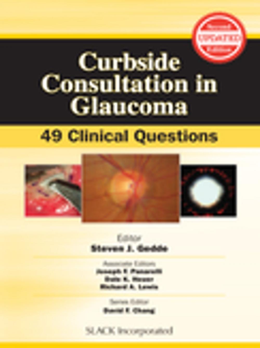 Big bigCover of Curbside Consultation in Glaucoma