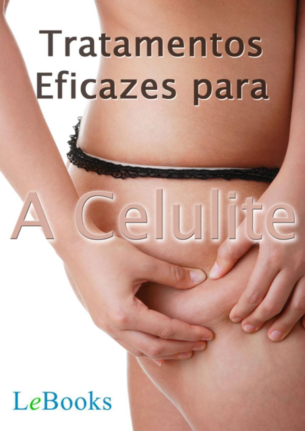 Big bigCover of Tratamentos eficazes para a celulite