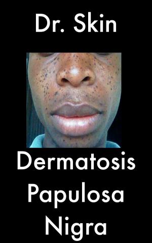 bigCover of the book Dermatosis Papulosa Nigra by 