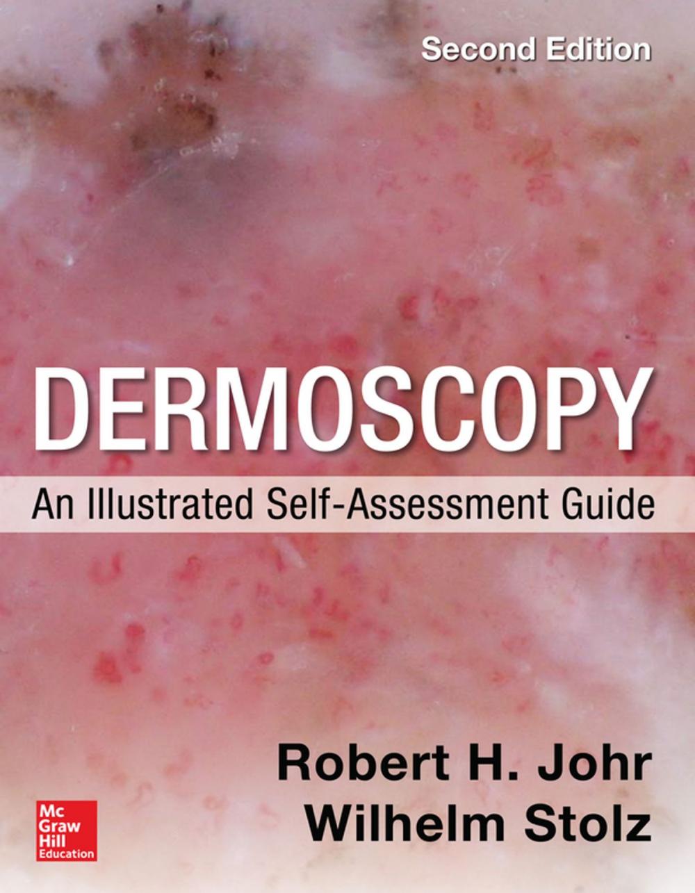 Big bigCover of Dermoscopy: An Illustrated Self-Assessment Guide