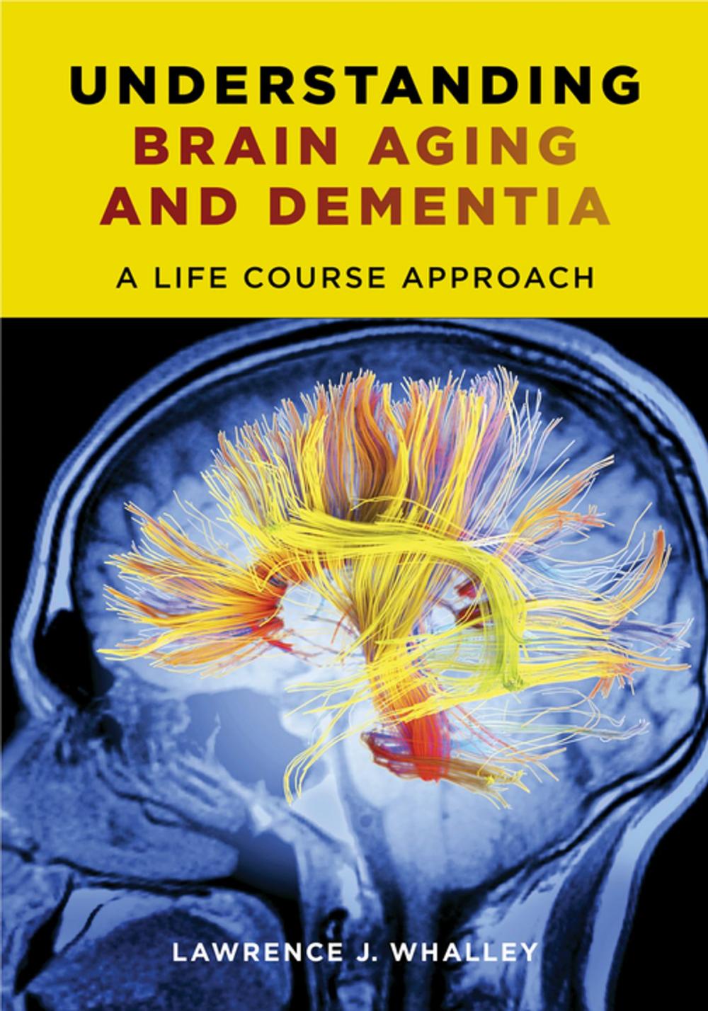 Big bigCover of Understanding Brain Aging and Dementia