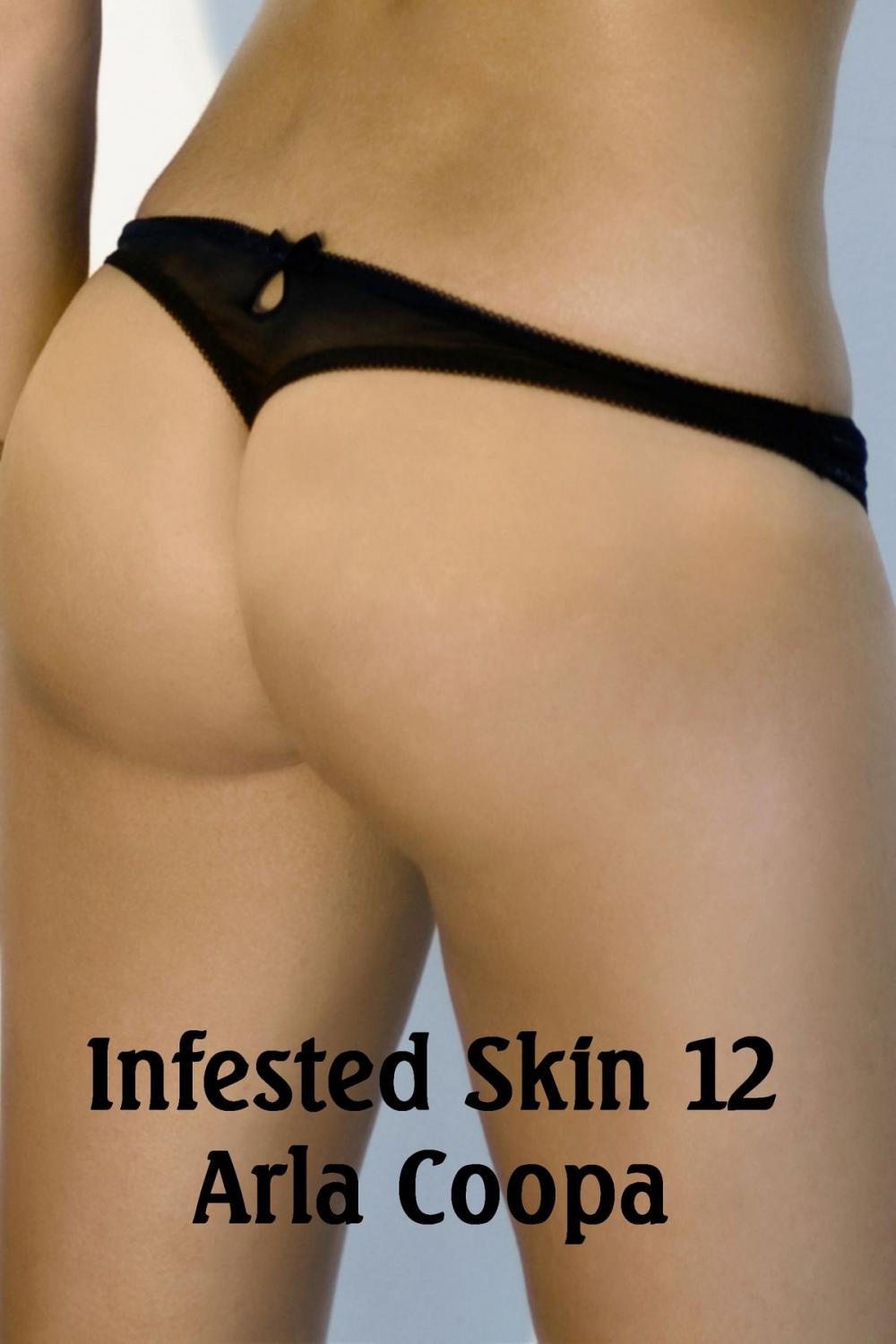 Big bigCover of Infested Skin 12