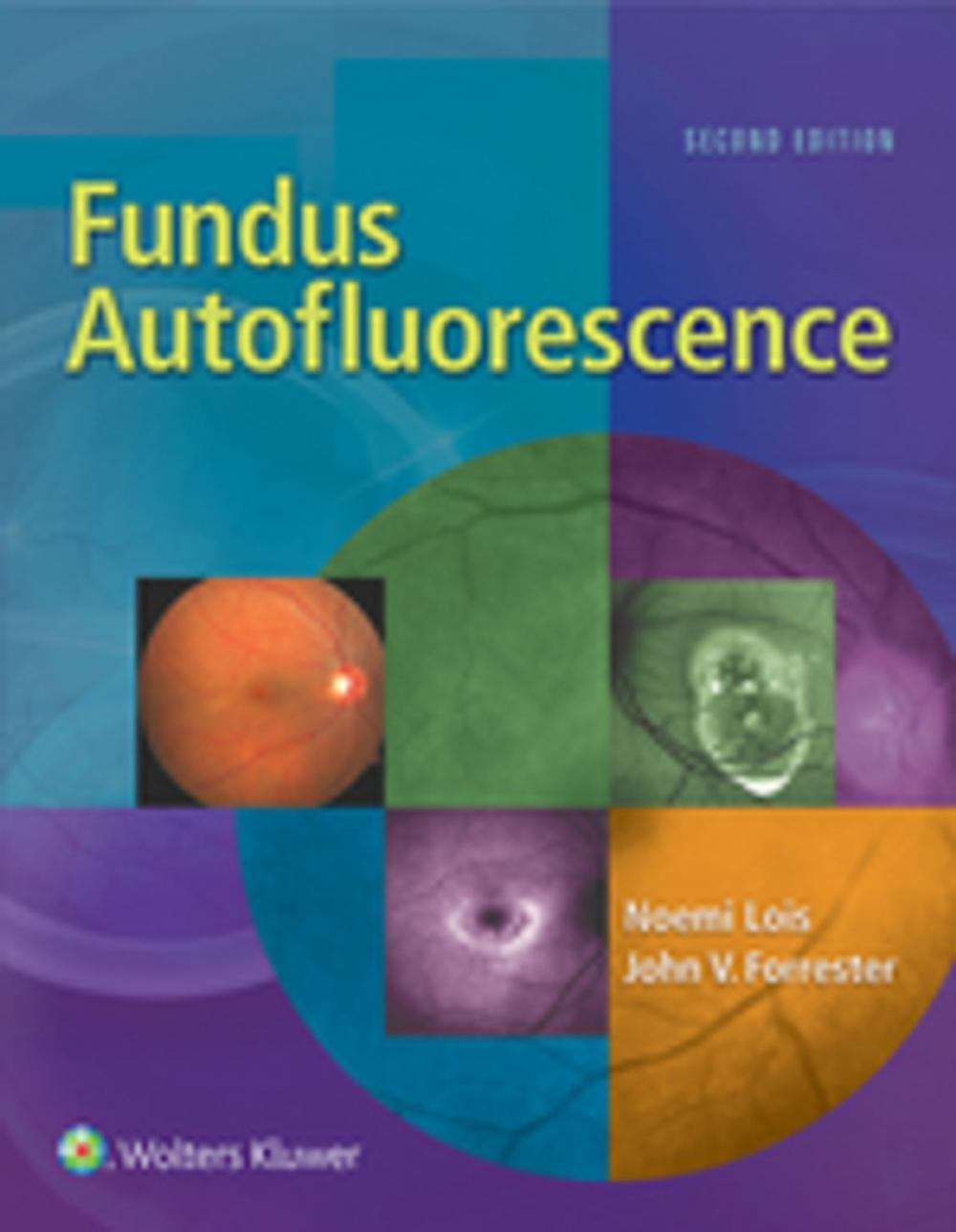 Big bigCover of Fundus Autofluorescence