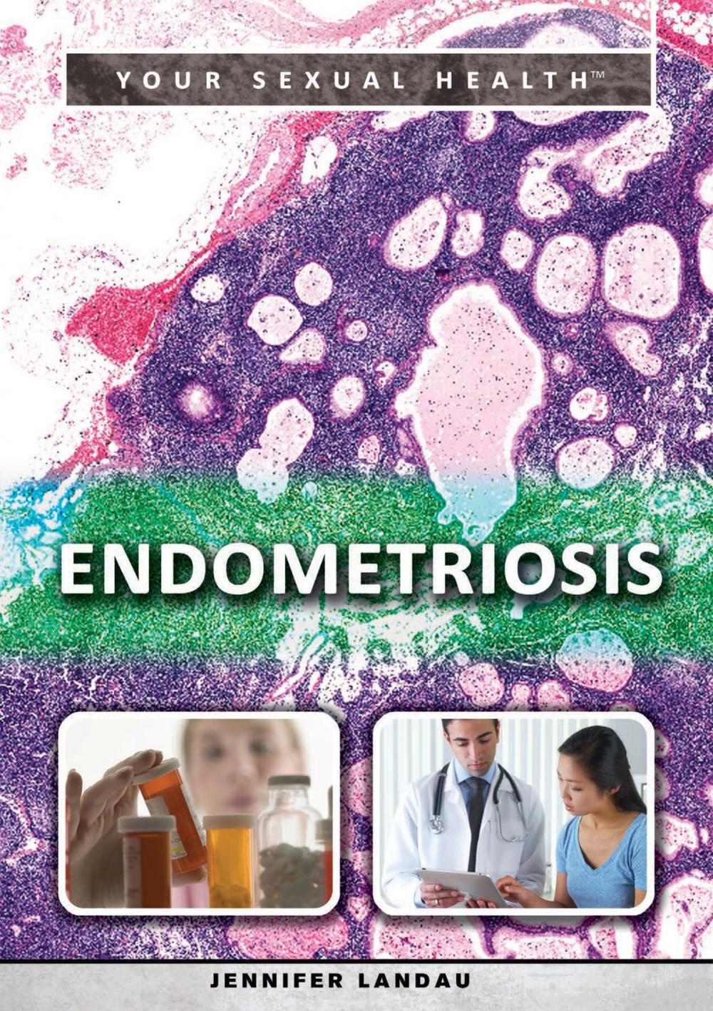 Big bigCover of Endometriosis