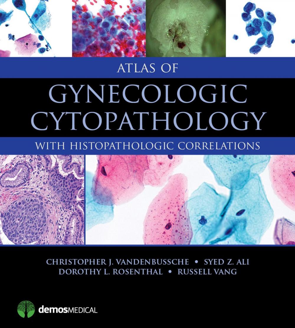 Big bigCover of Atlas of Gynecologic Cytopathology