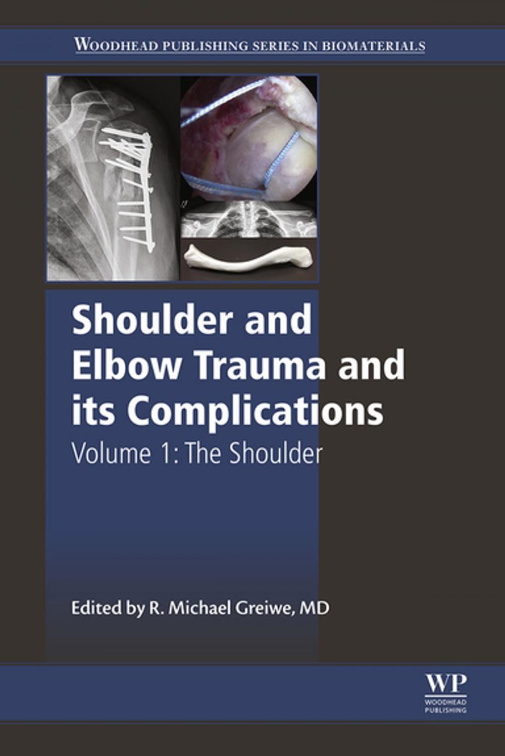 Big bigCover of Shoulder and Elbow Trauma and its Complications