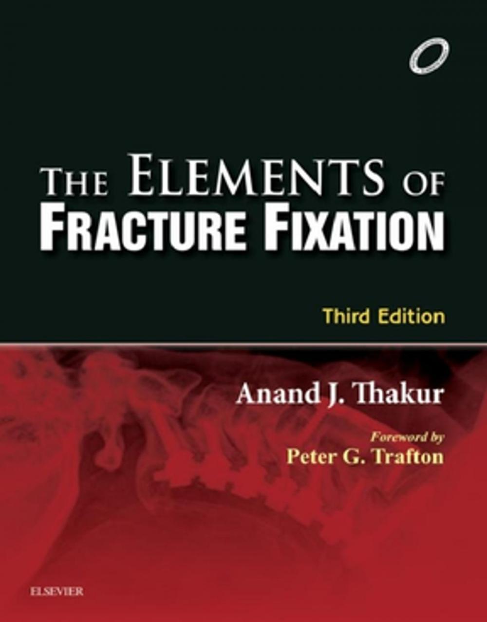 Big bigCover of Elements of Fracture Fixation - E-book