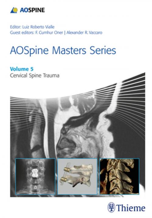 Cover of the book AOSpine Masters Series, Volume 5: Cervical Spine Trauma by Luiz Roberto Gomes Vialle, Thieme