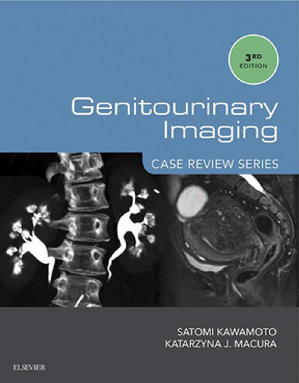 Big bigCover of Genitourinary Imaging: Case Review Series E-Book