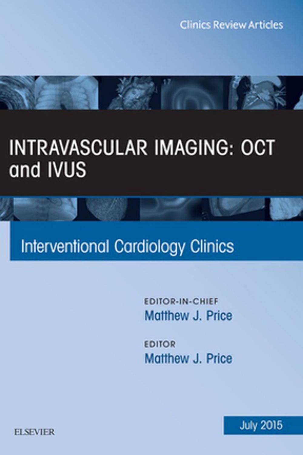 Big bigCover of Intravascular Imaging: OCT and IVUS, An Issue of Interventional Cardiology Clinics, E-Book