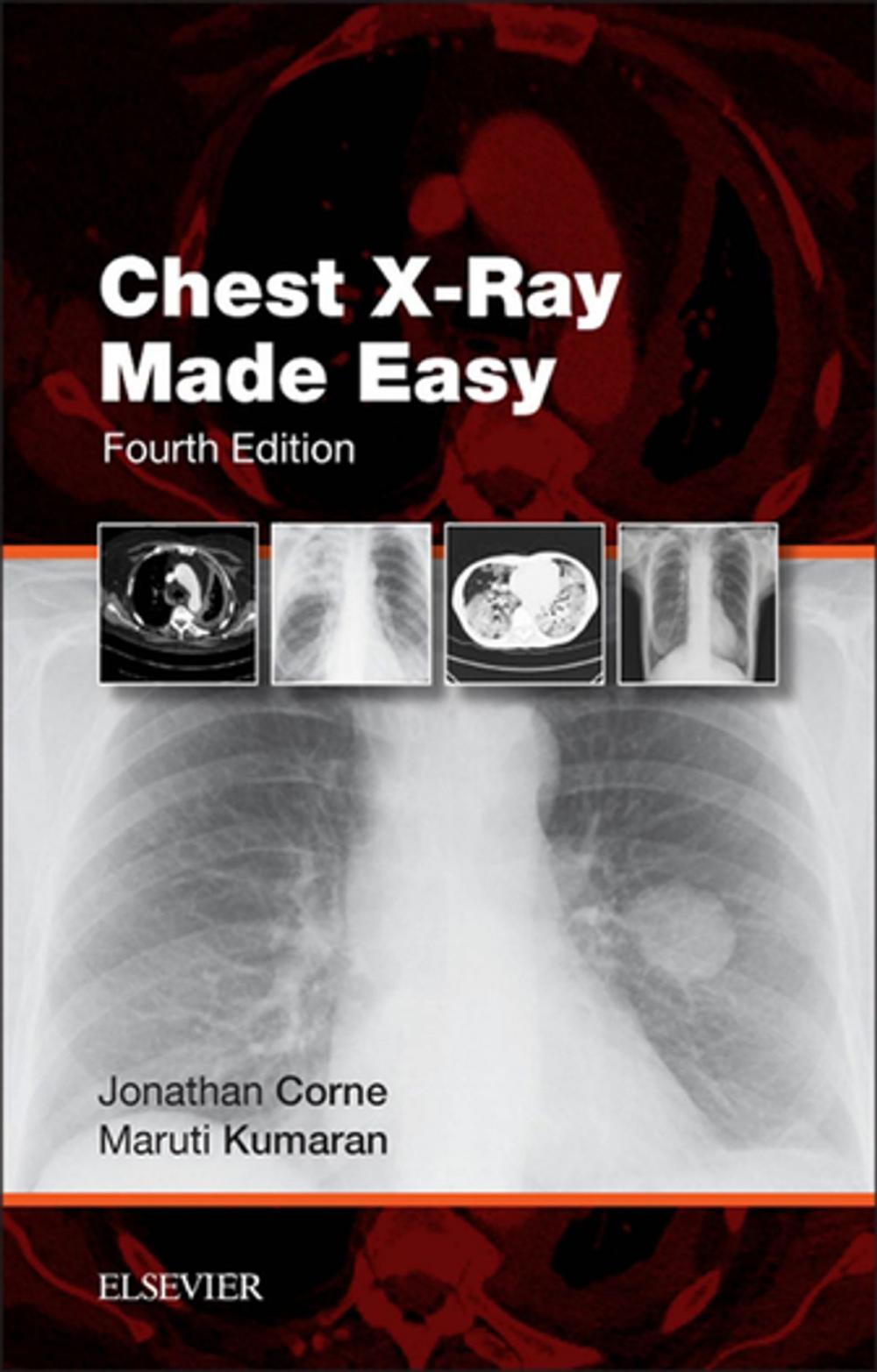 Big bigCover of Chest X-Ray Made Easy E-Book