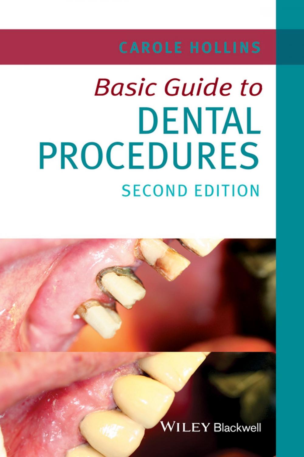 Big bigCover of Basic Guide to Dental Procedures