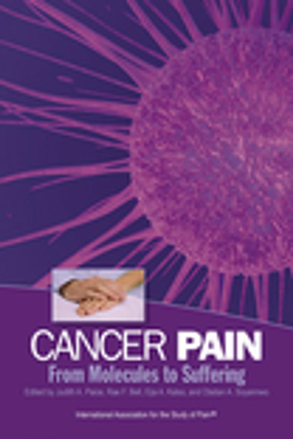 Big bigCover of Cancer Pain: From Molecules to Suffering