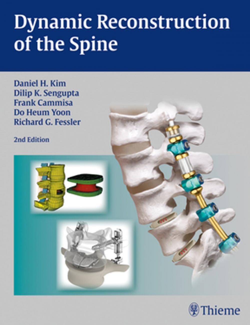 Big bigCover of Dynamic Reconstruction of the Spine