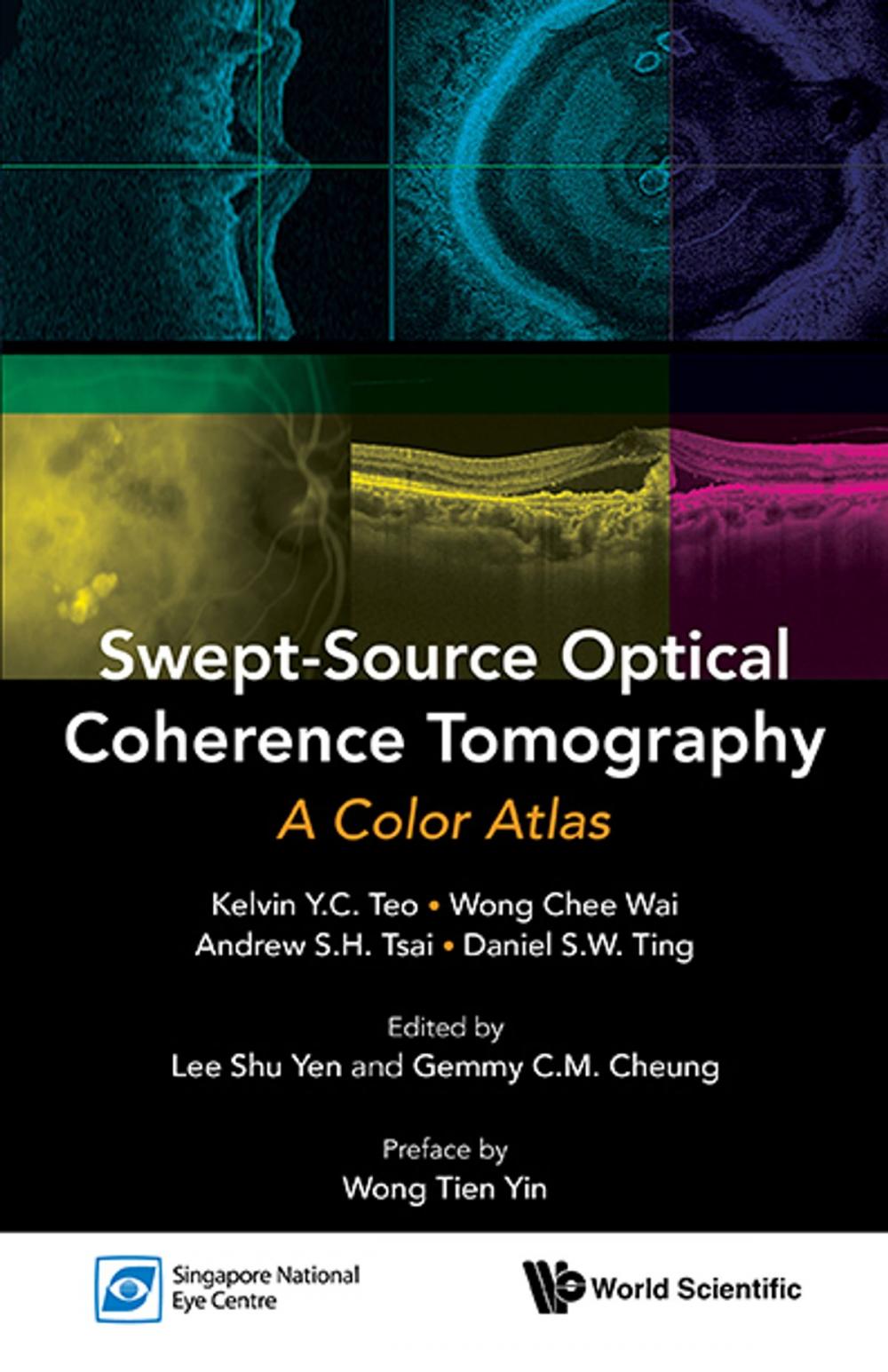 Big bigCover of Swept-Source Optical Coherence Tomography