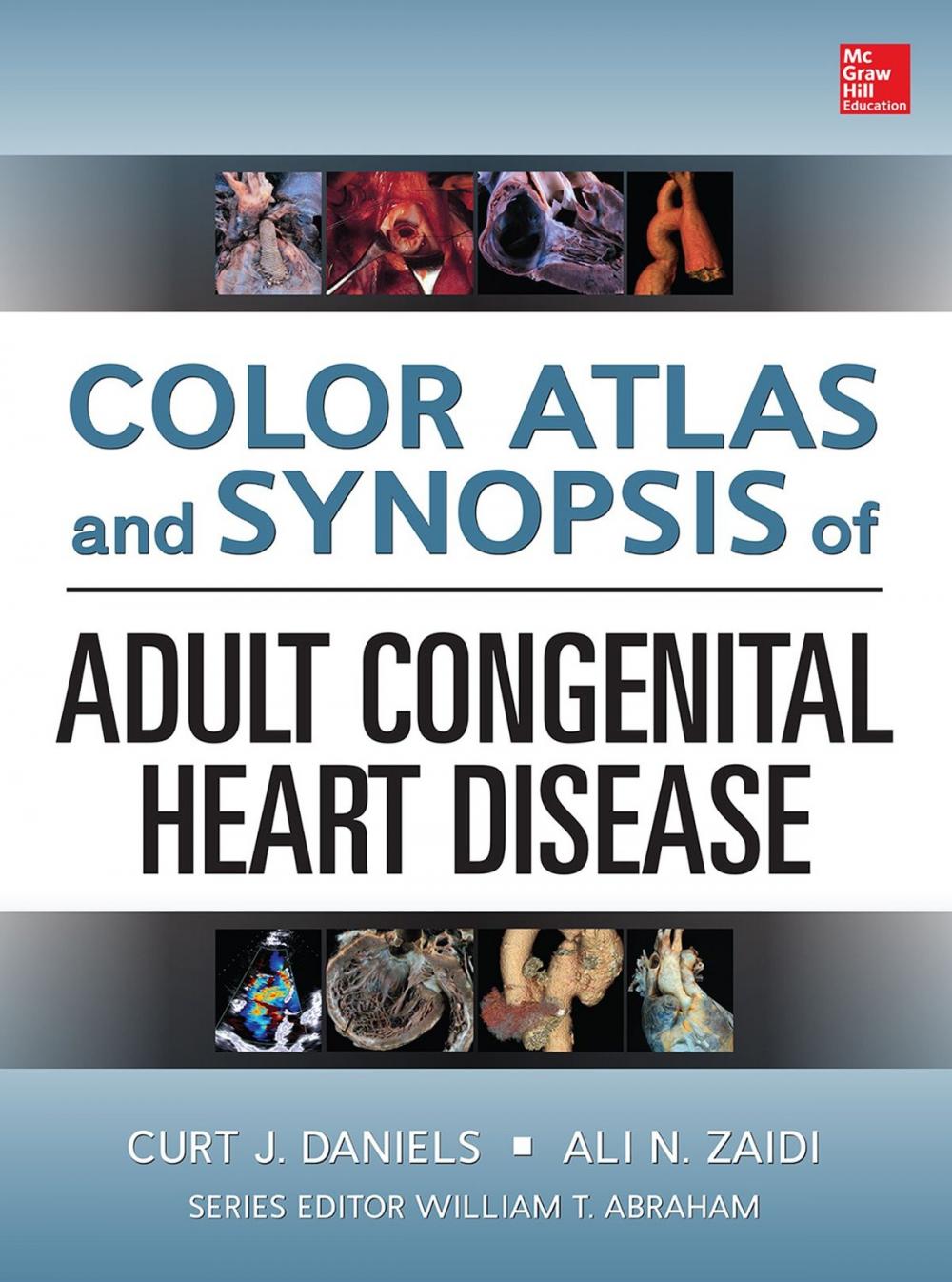 Big bigCover of Color Atlas and Synopsis of Adult Congenital Heart Disease