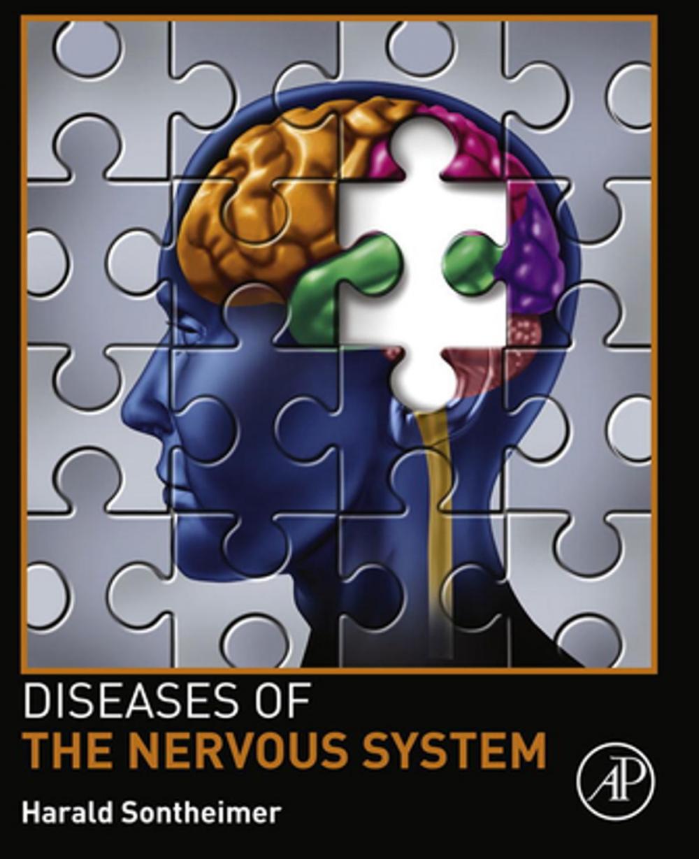 Big bigCover of Diseases of the Nervous System