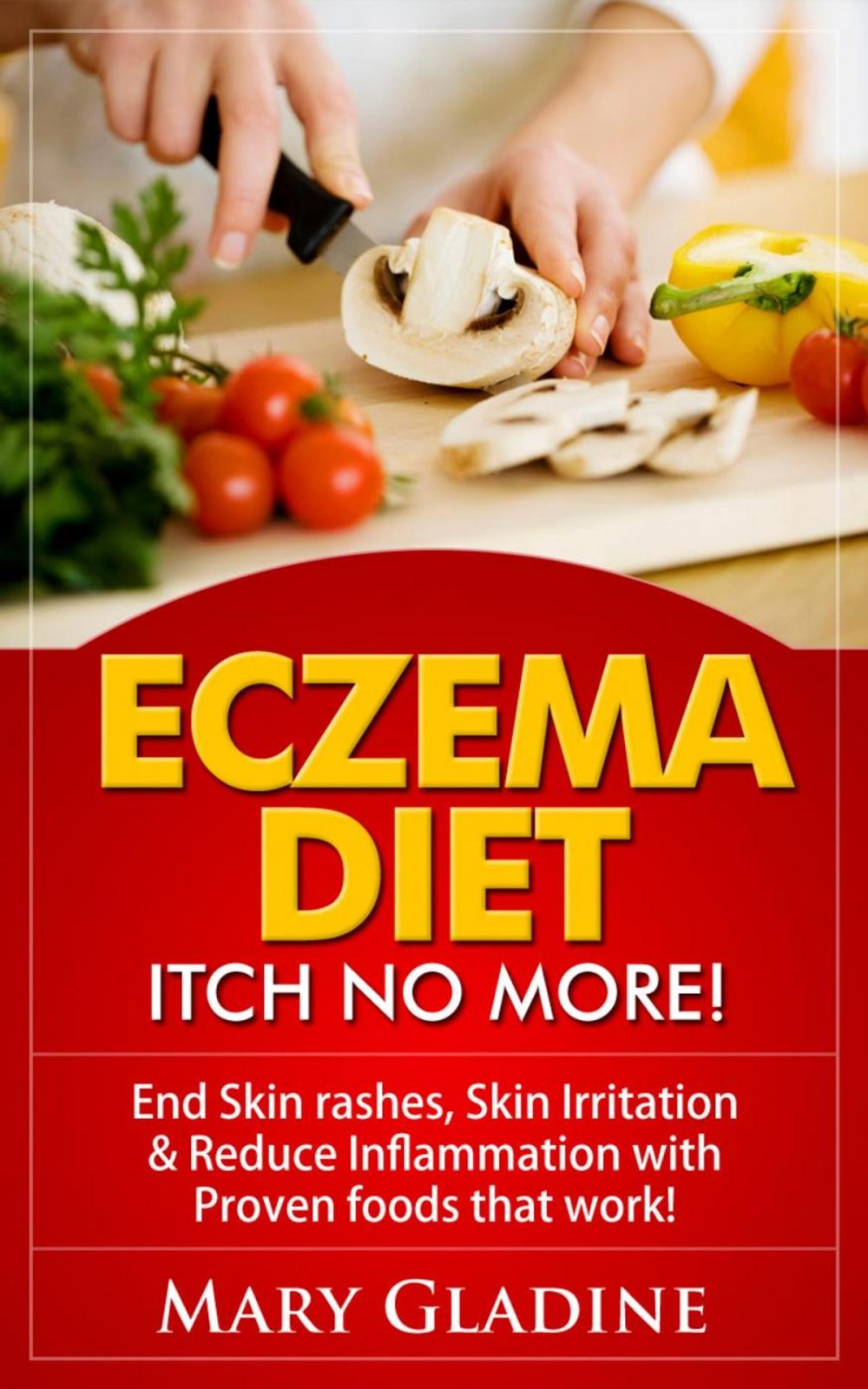 Big bigCover of Eczema Diet: Itch No More! End Skin rashes, skin irritation & reduce inflammation with A Low Inflammation Diet & Proven foods that work! BONUS know what to avoid!