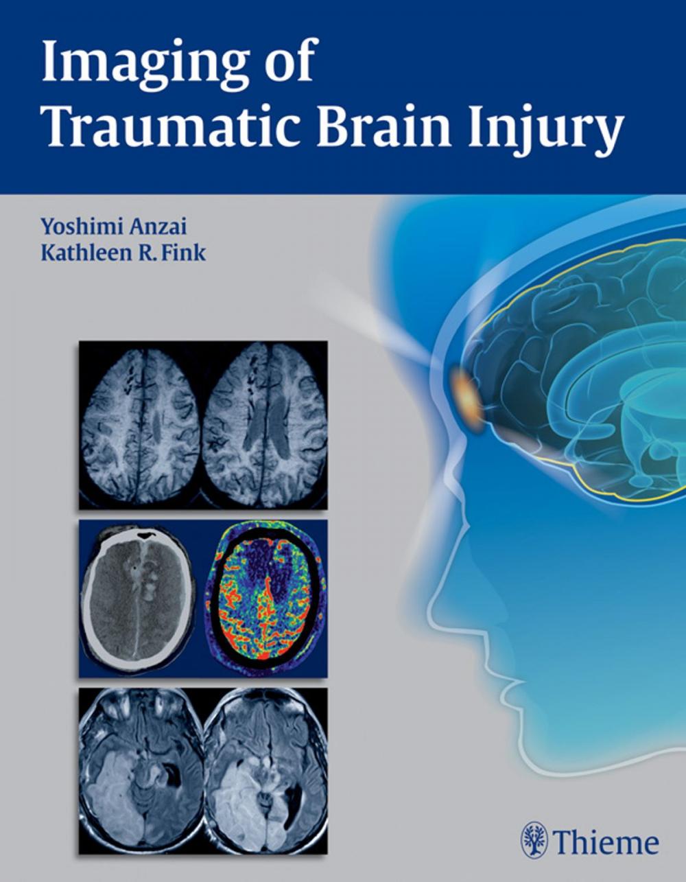 Big bigCover of Imaging of Traumatic Brain Injury