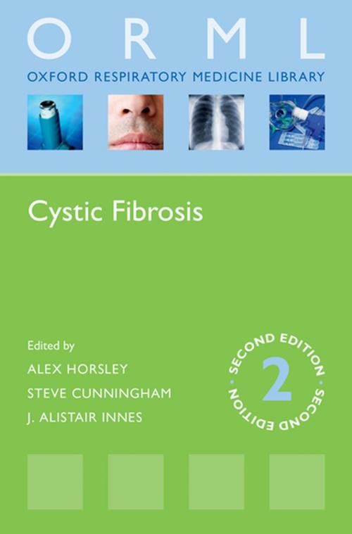 Cover of the book Cystic Fibrosis by , OUP Oxford